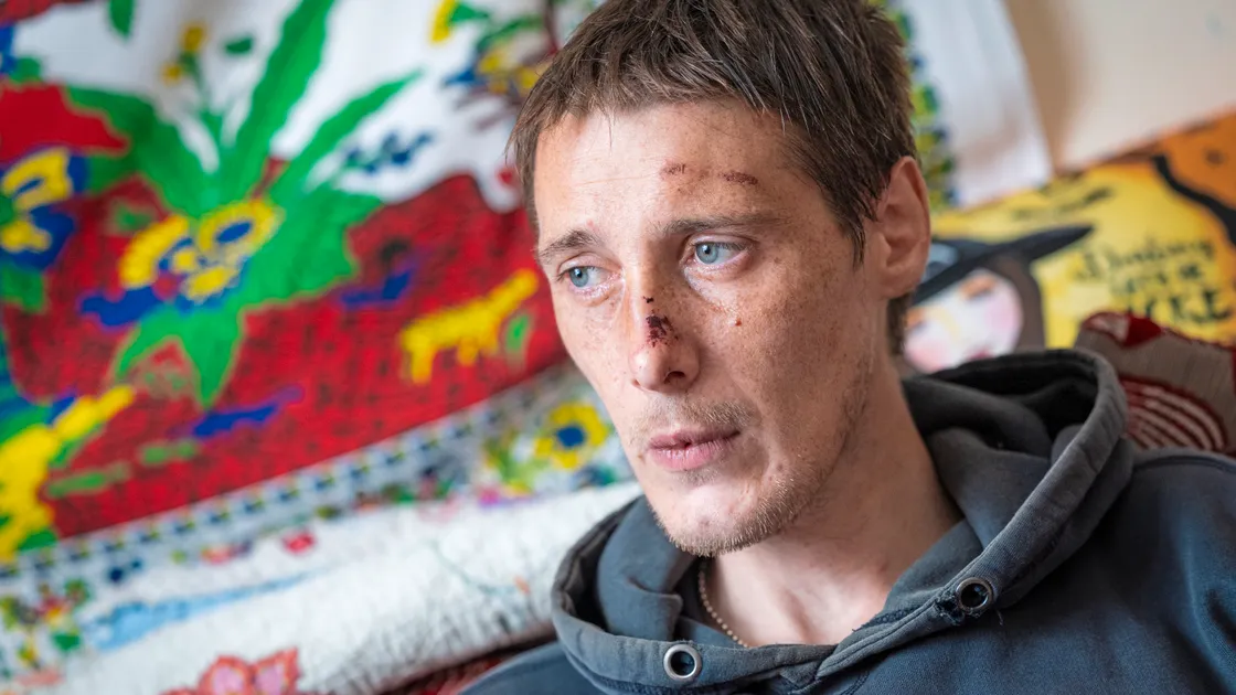 Steven Turner was arrested in a case of mistaken identity and believes he was unnecessarily injured during the arrest