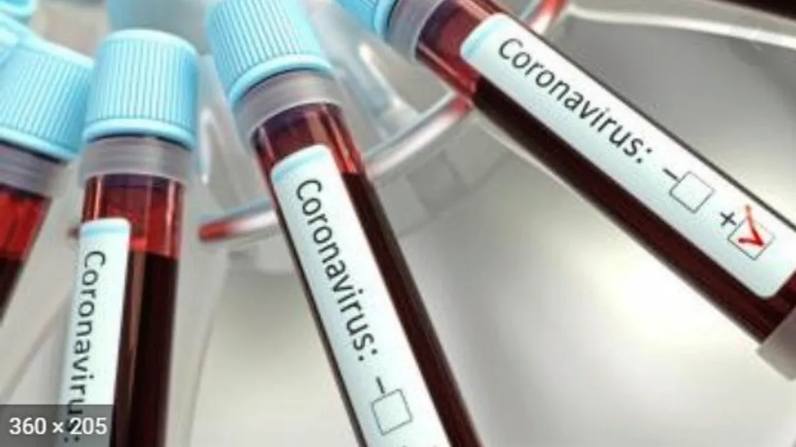 Strict new measures have been put in place to combat the spread of the coronavirus.
