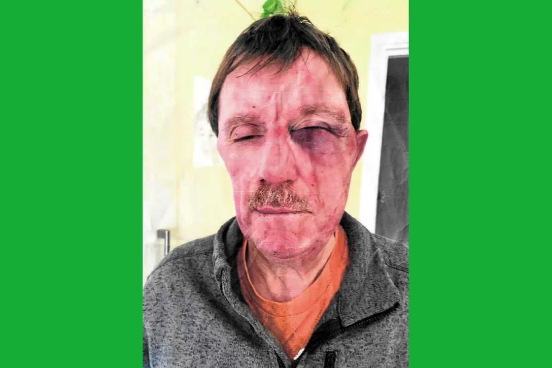 The attack left Mr Marsh with serious injuries, including a broken jaw, cracked sternum and broken left knee, as well as losing more than a dozen teeth.