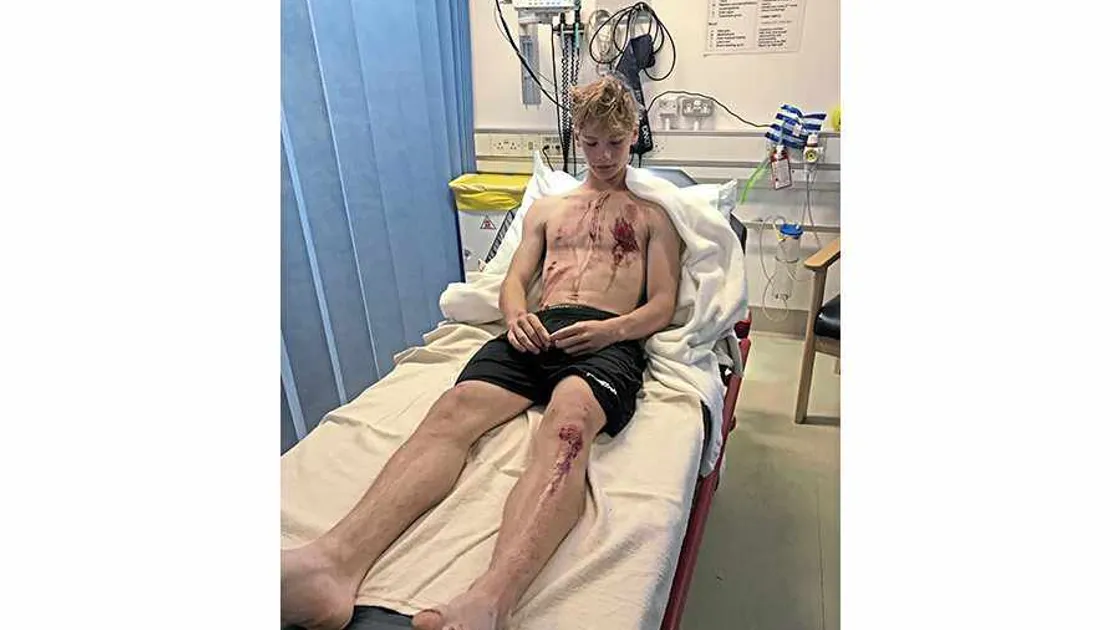 'You send them off to have fun and they come back all bloody'