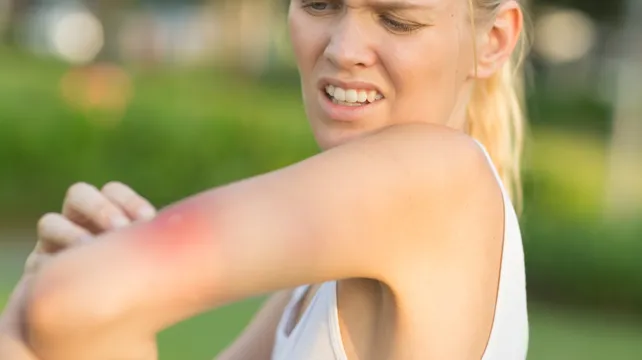 A sting in the tail: when bee and wasp reactions turn serious