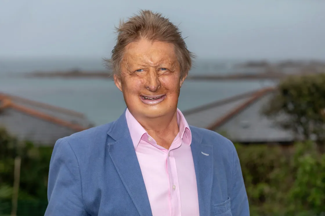 The Guardian - James Partridge OBE the founder and chief executive of the charity Changing Faces. (28592951)